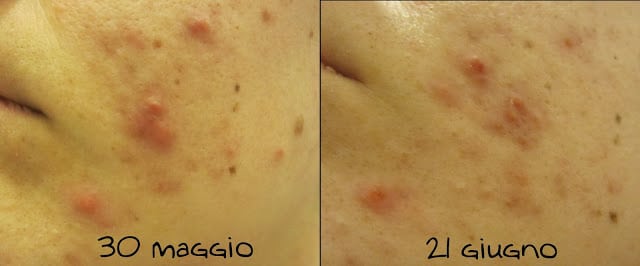 risultati elicina